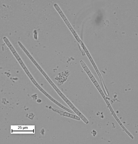 Konidien von 
<i>Cercospora beticola</i>
 unter dem Mikroskop.