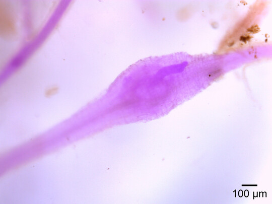 Ein mit Fuchsin gefrbter Wurzelknoten in den Feinwurzeln infizierter Ackersenfpflanzen, der einen juvenilen Nematoden enthlt.