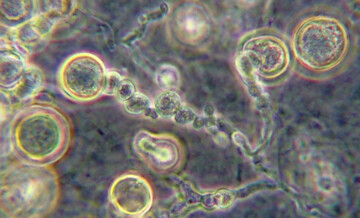 <i>Serendipita</i>
-Kultur mit Sporen in unterschiedlichen Reifungszust�nden. Die Mikroorganismen k�nnen die Salz- und Pathogentoleranz von Pflanzen steigern.