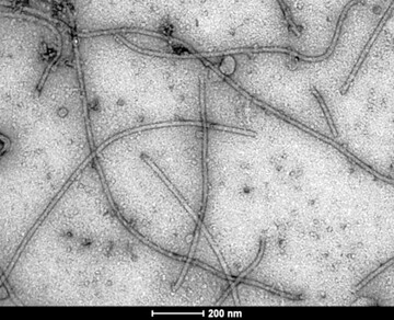 Elektronenmikroskopische Aufnahme von Asparagus-Virus 1-Viruspartikeln in Spargel.