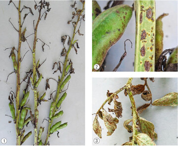 1 Vorzeitiges Absterben von Ackerbohnenblttern durch einen frhen und
starken Befall mit dem Ackerbohnenrost Uromyces viciae-fabae<br/>
2 Glnzende, schwarz-braune erhabene Pusteln am Stngel und an den Frchten
von Ackerbohnen durch einen Befall mit dem Ackerbohnenrost Uromyces viciaefabae<br/>
3 Orange, runde Pusteln sind die Sommersporenlager (Uredos) des Ackerbohnenrostes
Uromyces viciae-fabae