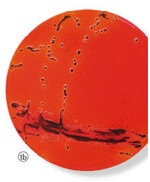 Abbildung 1a und 1b: Optimierung der
klassischen Kultivierungsmethode
mittels künstlich inokulierter Untersuchungsproben.
Links: Nach einer
Anreicherung über Nacht wurde 1ml
der Probe auf MSRV Medium (modified semi-solid rappaport Vassiliadis) gegeben
auf welchem eventuell vorhandene
Salmonellen schwärmen. Oben: Diese
werden auf einen Nährboden (zum
Beispiel XLD) übertragen, auf welchem
das Vorhandensein von Salmonellen
anhand der spezifischen Schwarzfärbung
der Kolonien ablesbar ist.