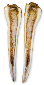 Nach einem Befall mit Sclerotinia sclerotiorum verfärbt sich das Gewebe von beige über hell- bis dunkelbraun und zerfällt faserig. Die Fäule endet oft an den Gefäßen.