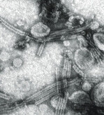 LBVaV-Partikel unter dem 
Elektronenmikroskop