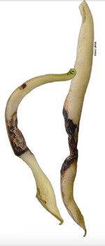 Schwarzbraun, zoniert umrandete Flecken mit den unter feuchten Bedingungen austretenden schleimigen, rosa Sporenmassen durch den erreger der Tüpfelkrankheit an Bohnen, dem Pilz Ascochyta boltshauseri