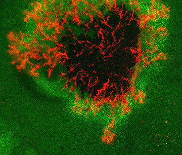 Infektionsstelle des Erregers der Knollenfule Phytophthora infestans auf einem Blatt. Die sich ausbreitenden Erregerhyphen sind rot-fluoreszierend markiert. Lebendes Blattgewebe ist grn, abgestorbenes Gewebe ist dunkel.